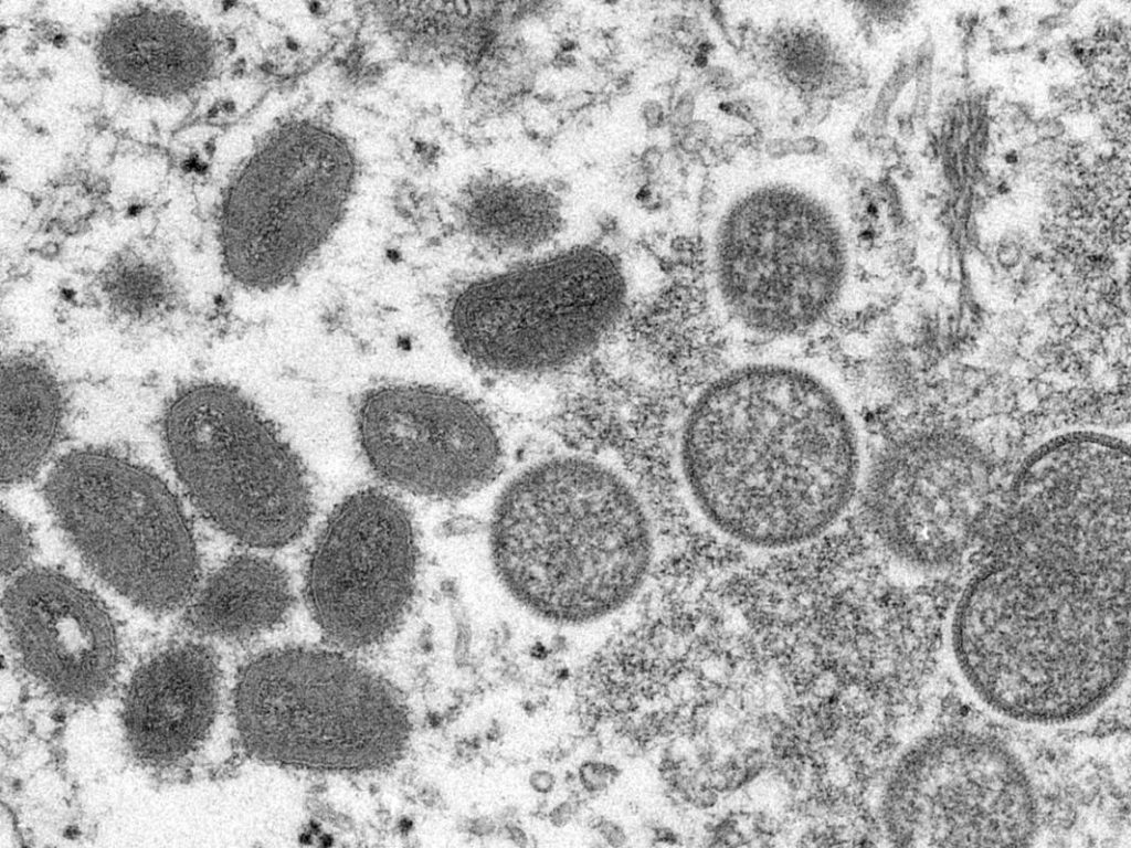 Monkeypox Cases; Gun Bills; Hepatitis A Outbreak: Top Ca Stories