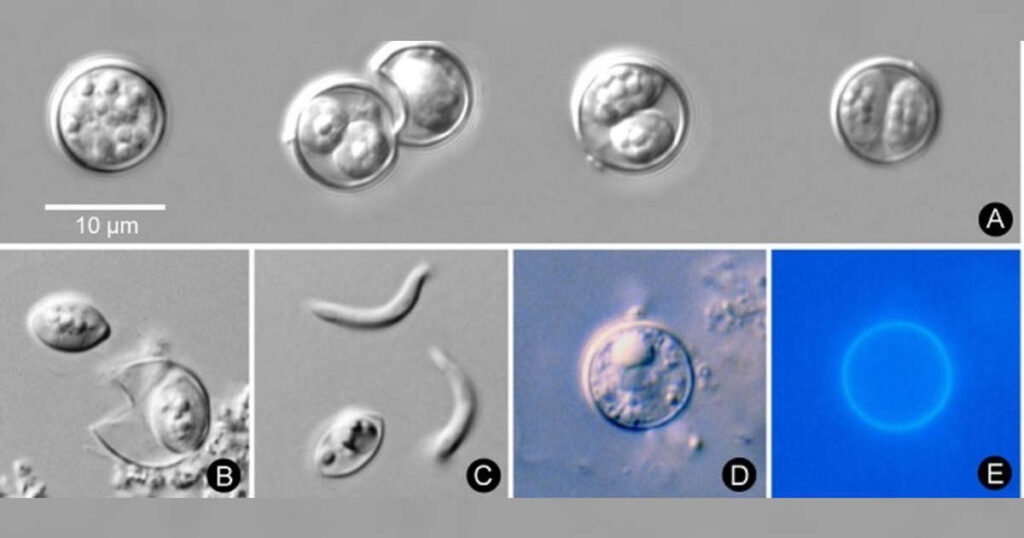 Health officials warn of microscopic parasite causing intestinal illness in northwest georgia