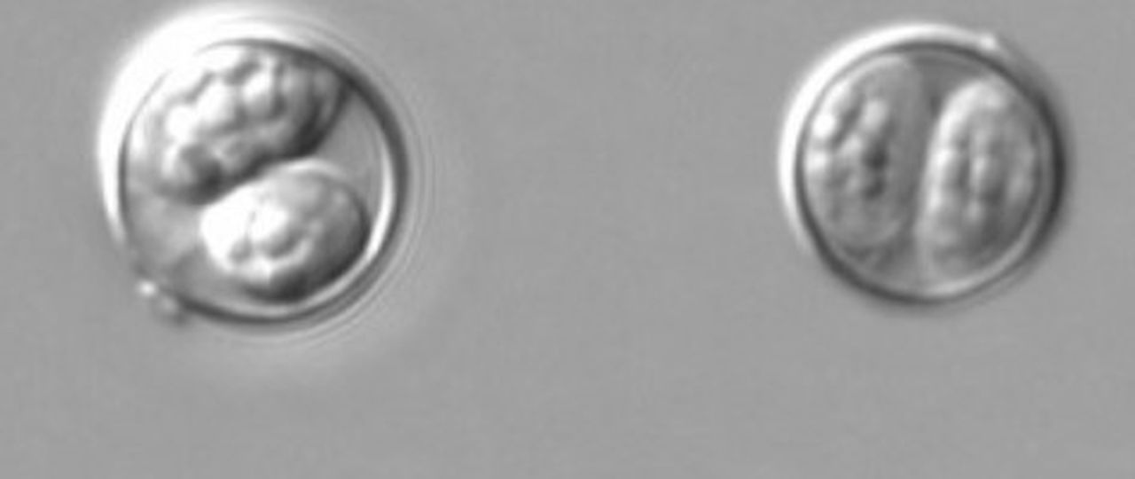 Multiple cases of gastro illness caused by parasite under investigation in alabama: what to know