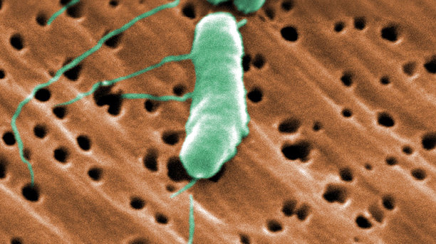 What to know about flesh eating bacteria vibrio vulnificus